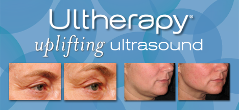 Ultherapy Uplifting Ultrasound in Virginia Beach