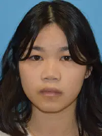 Rhinoplasty
